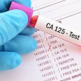 CA 125