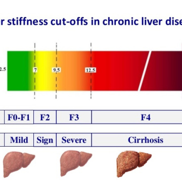 Liver Function Tests (Humanitarian Aid Program)