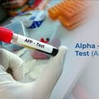Alpha Fetoprotein