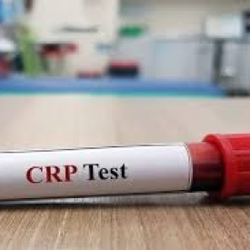 CRP Exams 