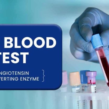 ACE Test