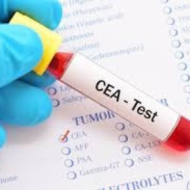 CEA Test